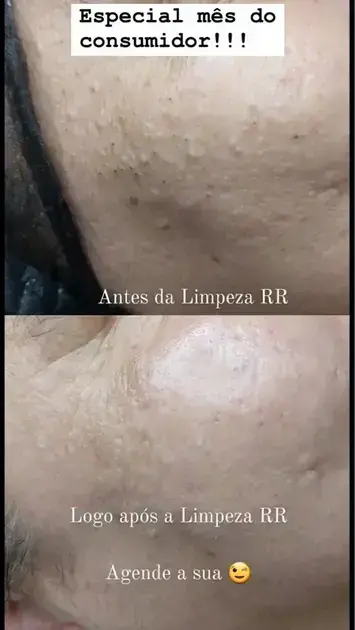 curso limpeza de pele gratuito